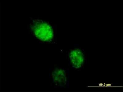 Immunocytochemistry/Immunofluorescence: hHR23b Antibody [H00005887-B01P] - Analysis of purified antibody to RAD23B on HeLa cell. (antibody concentration 10 ug/ml)