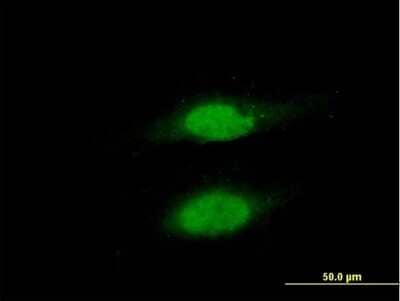 Immunocytochemistry/Immunofluorescence: hHR23b Antibody [H00005887-B02P] - Analysis of purified antibody to RAD23B on HeLa cell. (antibody concentration 10 ug/ml)