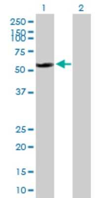 Western Blot: hHR23b Antibody [H00005887-B01P] - Analysis of RAD23B expression in transfected 293T cell line by RAD23B polyclonal antibody.  Lane 1: RAD23B transfected lysate(44.99 KDa). Lane 2: Non-transfected lysate.