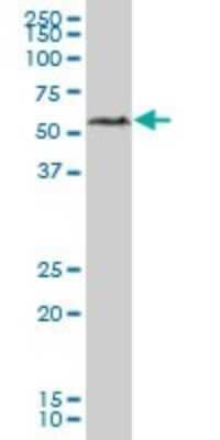 Western Blot: hHR23b Antibody [H00005887-B02P] - Analysis of RAD23B expression in human liver.