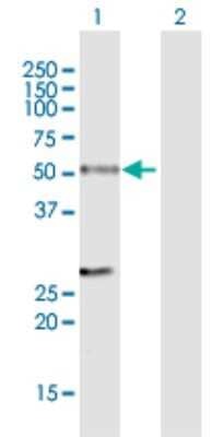 Western Blot: hHR23b Antibody [H00005887-B02P] - Analysis of RAD23B expression in transfected 293T cell line by RAD23B polyclonal antibody.  Lane 1: RAD23B transfected lysate(44.99 KDa). Lane 2: Non-transfected lysate.