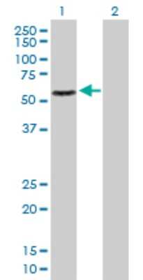 Western Blot: hHR23b Antibody [H00005887-D01P] - Analysis of RAD23B expression in transfected 293T cell line by RAD23B polyclonal antibody.Lane 1: RAD23B transfected lysate(43.20 KDa).Lane 2: Non-transfected lysate.