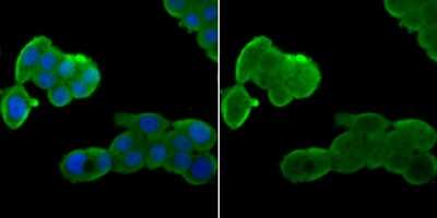 Immunocytochemistry/Immunofluorescence: hHpr1-p84-Thoc1 Antibody (JU53-18) [NBP2-75521] - Staining Nuclear Matrix Protein p84 in LOVO cells (green). The nuclear counter stain is DAPI (blue). Cells were fixed in paraformaldehyde, permeabilised with 0.25% Triton X100/PBS.