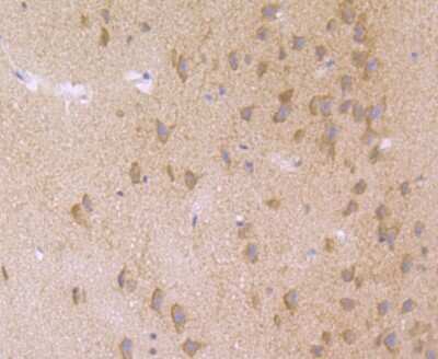 Immunohistochemistry-Paraffin: hHpr1-p84-Thoc1 Antibody (JU53-18) [NBP2-75521] - Analysis of paraffin-embedded rat brain tissue using anti-Nuclear Matrix Protein p84 antibody. Counter stained with hematoxylin.