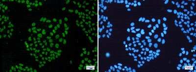 Immunocytochemistry/Immunofluorescence: hHpr1-p84-Thoc1 Antibody (S05-1A8) [NBP3-14940] - Immunofluorescence of hHpr1-p84-Thoc1 (green) in Hela cells using hHpr1-p84-Thoc1 Rabbit mAb at dilution 1/50, and DAPI (blue)