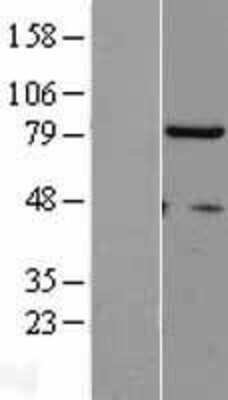 Western Blot hHpr1-p84-Thoc1 Overexpression Lysate