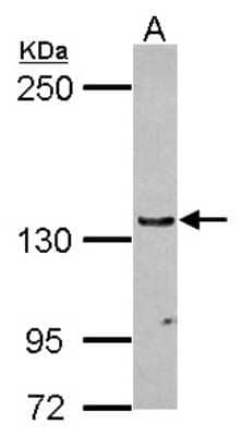 Western Blot: hUPF1 Antibody [NBP2-16905] - Sample (30 ug of whole cell lysate) A: A431 5% SDS PAGE gel, diluted at 1:500.