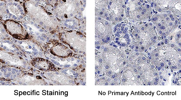 Detection of Vimentin in human kidney using 5 ug/mL of Rat monoclonal anti-human Vimentin primary antibody (MAB2105) followed by 30 min incubation with Goat anti Rat HRP conjugated secondary antibodies (Catalog # HAF005) at 1:20 dilution + DAB chromogen (brown). The tissue was counterstained with Hematoxylin (blue). Control was done by omitting primary antibody.