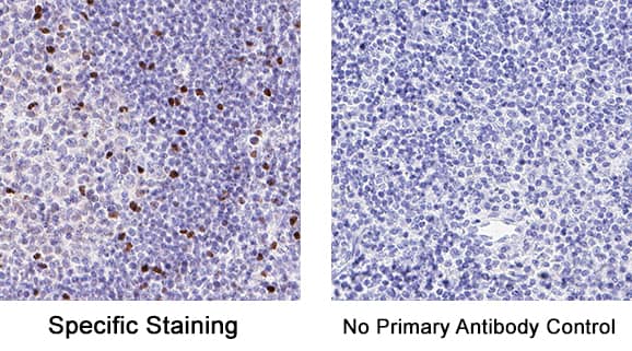 Anti-rat IgG, HRP-linked Antibody