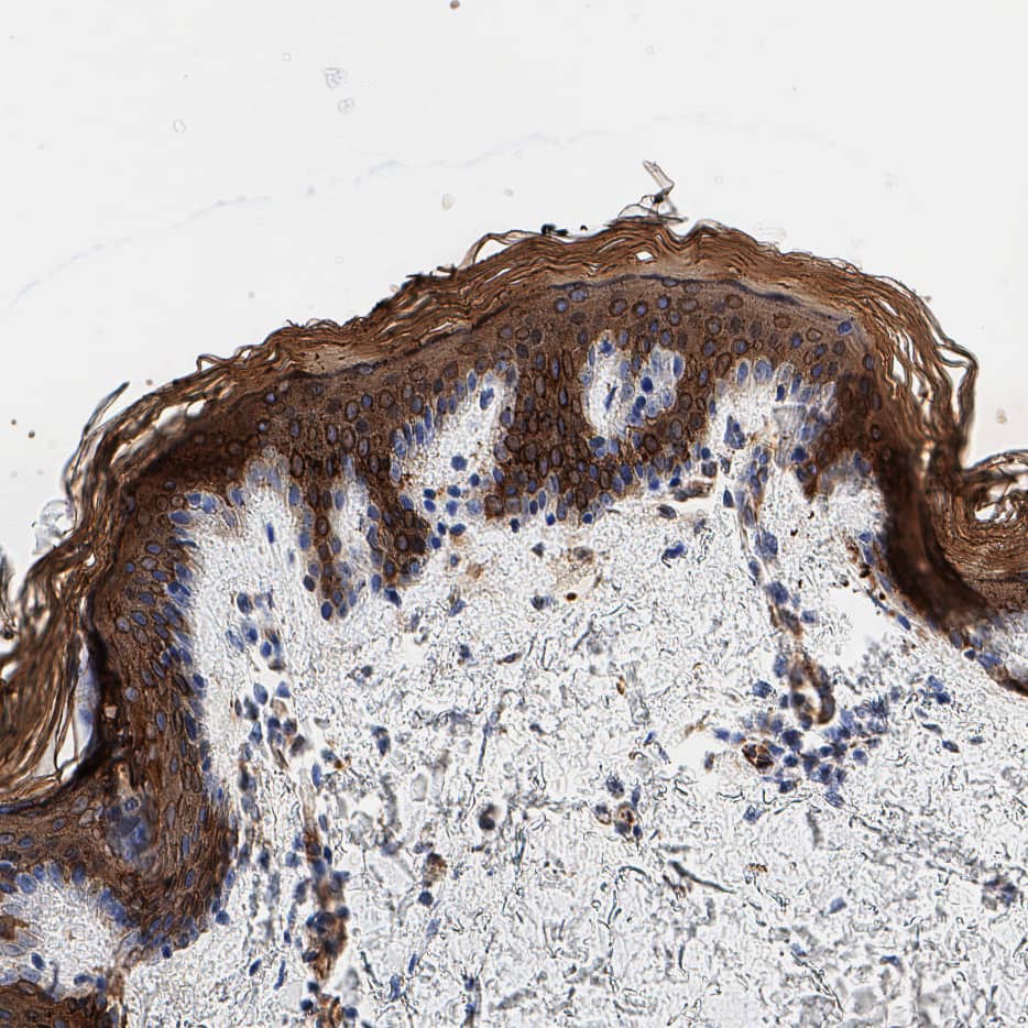 Cytokeratin 10 was detected in immersion fixed paraffin-embedded sections of human skin using Mouse Anti-Human Cytokeratin 10 Monoclonal Antibody (Catalog # MAB11806) at 5 µg/ml overnight at 4 &deg;C. Before incubation with the primary antibody, tissue was subjected to heat-induced epitope retrieval using VisUCyte Antigen Retrieval Reagent-Basic (Catalog # VCTS021) Tissue was stained with a 30 min incubation of Donkey anti Mouse HRP conjugated secondary antibodies (Catalog # HAF018) at 1:20 dilution + DAB chromogen (brown) and counterstained with hematoxylin (blue). Specific staining was localized to the membrane. View our protocol for Chromogenic IHC Staining of Paraffin-embedded Tissue Sections.