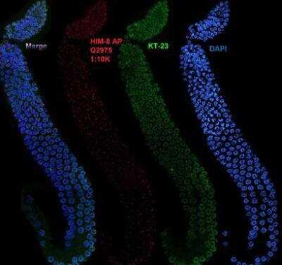 Immunocytochemistry/Immunofluorescence: him-8 Antibody [41980002] - This image is specific to animal number SDQ2975 Wild type 1:10000 Affinity Purified