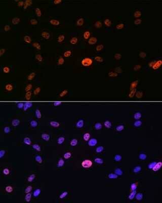 Immunocytochemistry/Immunofluorescence: hnRNP A1 Antibody (10N0F4) [NBP3-15405] - Immunofluorescence analysis of C6 cells using hnRNP A1 Rabbit mAb (NBP3-15405) at dilution of 1:100 (40x lens). Blue: DAPI for nuclear staining.