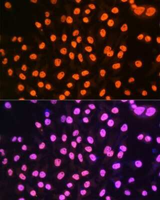 Immunocytochemistry/Immunofluorescence: hnRNP A1 Antibody (10N0F4) [NBP3-15405] - Immunofluorescence analysis of HeLa cells using hnRNP A1 Rabbit mAb (NBP3-15405) at dilution of 1:100 (40x lens). Blue: DAPI for nuclear staining.