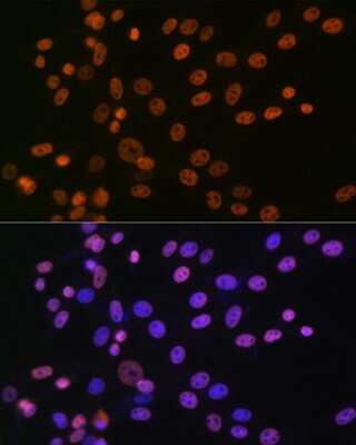 Immunocytochemistry/Immunofluorescence: hnRNP A1 Antibody (10N0F4) [NBP3-15405] - Immunofluorescence analysis of NIH-3T3 cells using hnRNP A1 Rabbit mAb (NBP3-15405) at dilution of 1:100 (40x lens). Blue: DAPI for nuclear staining.