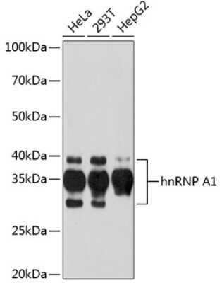 Western Blot: hnRNP A1 Antibody (10N0F4) [NBP3-15405] - Analysis of extracts of various cell lines, using hnRNP A1 Rabbit mAb (NBP3-15405) at 1:1000 dilution. Secondary antibody: HRP Goat Anti-Rabbit IgG (H+L) at 1:10000 dilution. Lysates/proteins: 25ug per lane. Blocking buffer: 3% nonfat dry milk in TBST. Detection: ECL Basic Kit. Exposure time: 60s.