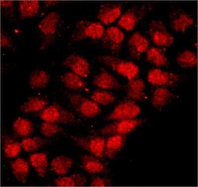 Immunocytochemistry/Immunofluorescence: hnRNP A1 Antibody (9H10) - Purified [NBP2-77365] - HeLa cells were fixed and permeabilized with cold methanol followed by cold methanol:acetone. Fixed cells were stained with 10 ug/mL of this antibody. The antibody was developed using Goat Anti-Mouse IgG, Cy3 conjugate.