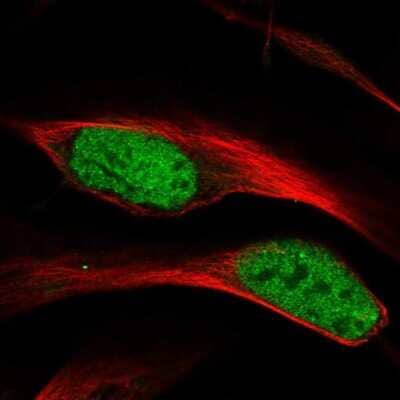 Immunocytochemistry/Immunofluorescence: hnRNP A1 Antibody [NBP2-58898] - Staining of human cell line U-2 OS shows localization to nucleoplasm. Antibody staining is shown in green. 