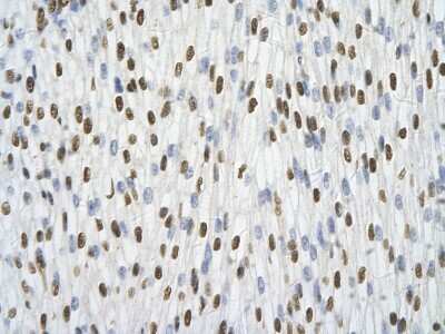 Immunohistochemistry: hnRNP A1 Antibody [NBP1-57121] - Human Heart cell Cellular data: cardiac cell of renal tubule Antibody Concentration: 4.0-8.0 ug/ml Magnification: 400X.