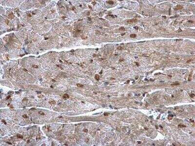 Immunohistochemistry-Paraffin: hnRNP A1 Antibody [NBP1-32161] - hnRNP A1 antibody detects hnRNP A1 protein at nucleus on mouse heart by immunohistochemical analysis. Sample: Paraffin-embedded mouse heart. hnRNP A1 antibody diluted at 1:500.