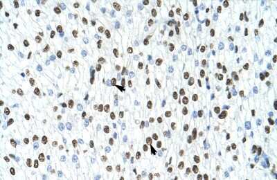 Immunohistochemistry-Paraffin: hnRNP A1 Antibody [NBP1-57121] - Human Heart Tissue, antibody concentration 4-8ug/ml. Cells with positive label: Myocardial cells (indicated with arrows) 400X magnification.