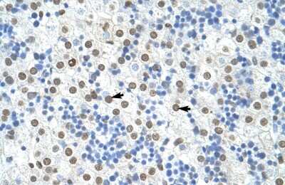 Immunohistochemistry-Paraffin: hnRNP A1 Antibody [NBP1-57121] - Human Liver Tissue, antibody concentration 4-8ug/ml. Cells with positive label: Hepatocytes (indicated with arrows) 400X magnification.