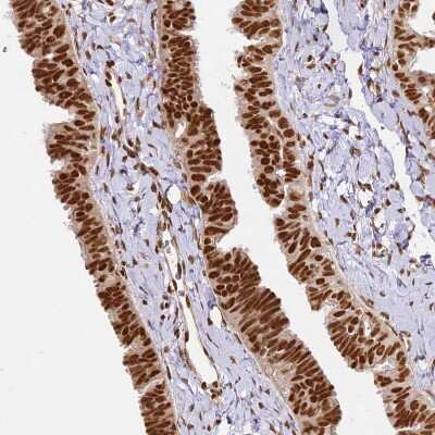 Immunohistochemistry-Paraffin: hnRNP A1 Antibody [NBP2-14096] - Staining of human Fallopian tube shows strong nuclear positivity in glandular cells.