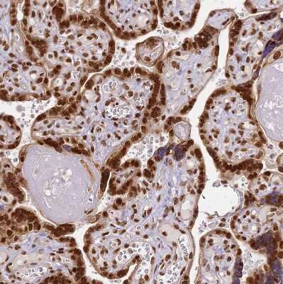 Immunohistochemistry-Paraffin: hnRNP A1 Antibody [NBP2-14096] - Staining of human placenta shows strong nuclear positivity in trophoblastic cells.