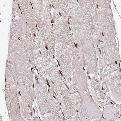 Immunohistochemistry-Paraffin: hnRNP A1 Antibody [NBP2-14096] - Staining of human skeletal muscle shows strong nuclear positivity in myocytes.