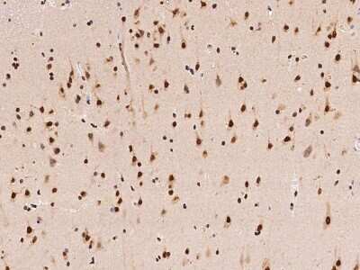 Immunohistochemistry-Paraffin: hnRNP A1 Antibody [NBP2-97829] - Immunochemical staining of human hnRNP A1 in human brain with rabbit polyclonal antibody at 1:100 dilution, formalin-fixed paraffin embedded sections.