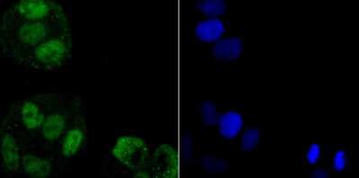 Immunocytochemistry/Immunofluorescence: hnRNP A1 Antibody (JA39-21) [NBP2-66891] - Staining hnRNP A1 in Hela cells (green). The nuclear counter stain is DAPI (blue). Cells were fixed in paraformaldehyde, permeabilised with 0.25% Triton X100/PBS.