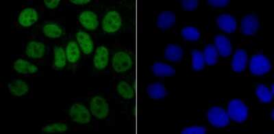 Immunocytochemistry/Immunofluorescence: hnRNP A1 Antibody (JA39-21) [NBP2-66891] - Staining hnRNP A1 in MCF-7 cells (green). The nuclear counter stain is DAPI (blue). Cells were fixed in paraformaldehyde, permeabilised with 0.25% Triton X100/PBS.