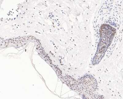 Immunohistochemistry-Paraffin: hnRNP A1 Antibody (JA39-21) [NBP2-66891] - Immunohistochemical analysis of paraffin-embedded human skin tissue using anti-hnRNP A1 antibody. The section was pre-treated using heat mediated antigen retrieval with sodium citrate buffer (pH 6.0) for 20 minutes. The tissues were blocked in 5% BSA for 30 minutes at room temperature, washed with ddH2O and PBS, and then probed with the primary antibody (1/200) for 30 minutes at room temperature. The detection was performed using an HRP conjugated compact polymer system. DAB was used as the chromogen. Tissues were counterstained with hematoxylin and mounted with DPX.
