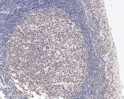 Immunohistochemistry-Paraffin: hnRNP A1 Antibody (JA39-21) [NBP2-66891] - Immunohistochemical analysis of paraffin-embedded human tonsil tissue using anti-hnRNP A1 antibody. The section was pre-treated using heat mediated antigen retrieval with sodium citrate buffer (pH 6.0) for 20 minutes. The tissues were blocked in 5% BSA for 30 minutes at room temperature, washed with ddH2O and PBS, and then probed with the primary antibody (1/200) for 30 minutes at room temperature. The detection was performed using an HRP conjugated compact polymer system. DAB was used as the chromogen. Tissues were counterstained with hematoxylin and mounted with DPX.