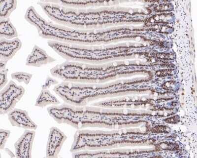 Immunohistochemistry-Paraffin: hnRNP A1 Antibody (JA39-21) [NBP2-66891] - Immunohistochemical analysis of paraffin-embedded mouse colon tissue using anti-hnRNP A1 antibody. The section was pre-treated using heat mediated antigen retrieval with sodium citrate buffer (pH 6.0) for 20 minutes. The tissues were blocked in 5% BSA for 30 minutes at room temperature, washed with ddH2O and PBS, and then probed with the primary antibody (1/200) for 30 minutes at room temperature. The detection was performed using an HRP conjugated compact polymer system. DAB was used as the chromogen. Tissues were counterstained with hematoxylin and mounted with DPX.