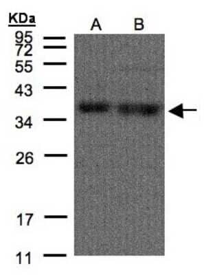 Western Blot: hnRNP A1 Antibody [NBP1-32161] - Sample(30 ug of whole cell lysate) A:H1299 B:HeLa S3 12% SDS PAGE, antibody diluted at 1:500.