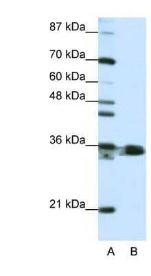 Western Blot: hnRNP A1 Antibody [NBP1-57121] - Jurkat cell lysate, Antibody Titration: 1.25ug/ml