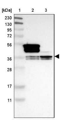 Western Blot: hnRNP A1 Antibody [NBP2-14096] - Lane 1: Marker  [kDa] 230, 130, 95, 72, 56, 36, 28, 17, 11.  Lane 2: Human cell line RT-4.  Lane 3: Human cell line U-251MG sp