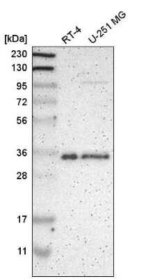 Western Blot: hnRNP A1 Antibody [NBP2-58898] - Analysis in human cell line RT-4 and human cell line U-251 MG.