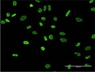 Immunocytochemistry/Immunofluorescence: hnRNP A2B1 Antibody (3G11-6A7) [H00003181-M02] - Analysis of monoclonal antibody to HNRNPA2B1 on HeLa cell . Antibody concentration 10 ug/ml.