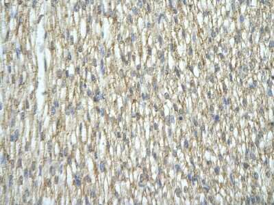 Immunohistochemistry: hnRNP A2B1 Antibody [NBP1-57166] - Human Heart cell Cellular data: cardiac cell of renal tubule Antibody Concentration: 4.0-8.0 ug/ml Magnification: 400X.