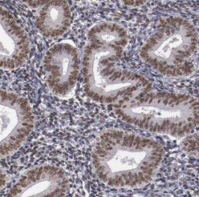 Immunohistochemistry-Paraffin: hnRNP A2B1 Antibody [NBP1-89675] - Staining of human endometrium shows moderate nuclear positivity in glandular cells.