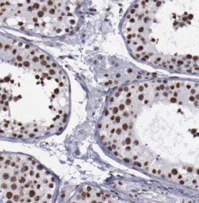 Immunohistochemistry-Paraffin: hnRNP A2B1 Antibody [NBP1-89675] - Staining of human testis shows strong nuclear positivity in cells in seminiferous ducts.