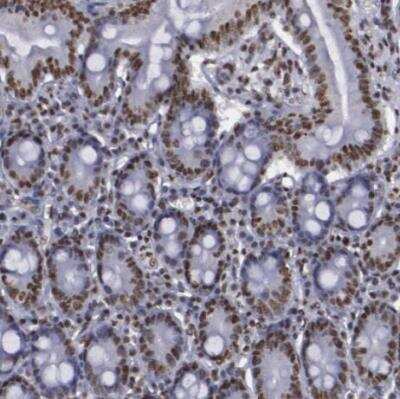 Immunohistochemistry-Paraffin: hnRNP A2B1 Antibody [NBP1-89675] - Staining of human small intestine shows strong nuclear positivity in glandular cells. 