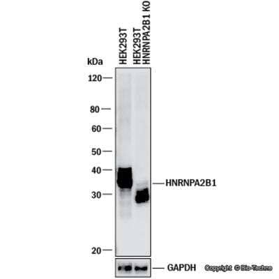 Knockout Validated: hnRNP A2B1 Antibody [NBP2-56497] - Western blot shows lysates of HEK293T human embryonic kidney parental cell line and hnRNP A2B1 knockout (KO) HEK293T cell line. PVDF membrane was probed with 0.4 ug/ml of Rabbit Anti-Human hnRNP A2B1 Polyclonal Antibody (Catalog # NBP2-56497) followed by HRP-conjugated Anti-Rabbit IgG Secondary Antibody (Catalog #HAF008). Specific band was detected for hnRNP A2B1 at approximately 35 kDa (as indicated) in the parental HEK293T cell line, but is not detectable in the knockout HEK293T cell line. This experiment was conducted under reducing conditions.