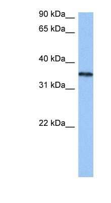 Western Blot: hnRNP A2B1 Antibody [NBP1-57166] - Jurkat cell lysate, concentration 0.2-1 ug/ml.