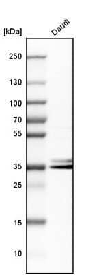 Western Blot: hnRNP A2B1 Antibody [NBP1-89675] - Analysis in human cell line Daudi.