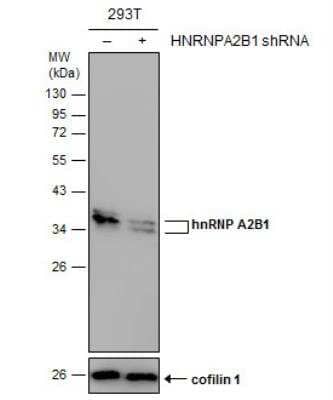 Western Blot: hnRNP A2B1 Antibody [NBP2-16864] - Non-transfected (-) and transfected (+) 293T whole cell extracts (30 ug) were separated by 12% SDS-PAGE, and the membrane was blotted with hnRNP A2B1 antibody diluted at 1:5000.