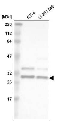 Western Blot: hnRNP A2B1 Antibody [NBP2-58872] - Western blot analysis in human cell line RT-4 and human cell line U-251 MG.