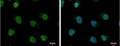 Immunocytochemistry/Immunofluorescence: hnRNP AB Antibody [NBP2-16865] - HeLa cells were fixed in 4% paraformaldehyde at RT for 15 min. Green: hnRNP A/B protein stained by hnRNP A/B antibody diluted at 1:500. Blue: Hoechst 33342 staining. Scale bar = 10 um.