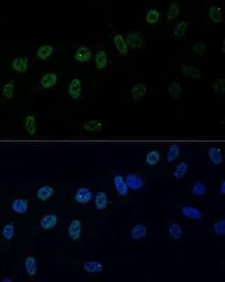 Immunocytochemistry/Immunofluorescence: hnRNP AB Antibody [NBP3-03424] - Analysis of U-2 OS cells using hnRNP AB antibody at dilution of 1:100. Blue: DAPI for nuclear staining.